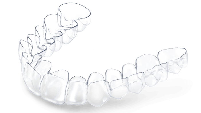 Embraces Aligners